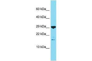 Host: Rabbit Target Name: C16orf87 Sample Type: OVCAR-3 Whole Cell lysates Antibody Dilution: 1. (C16ORF87 抗体  (N-Term))