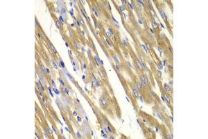 Immunohistochemistry of paraffin-embedded rat heart using TYR antibody. (TYR 抗体)