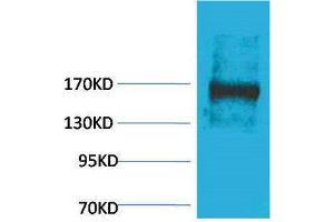 Western Blotting (WB) image for anti-Ectopic P-Granules Autophagy Protein 5 Homolog (EPG5) antibody (ABIN3181524) (EPG5 抗体)