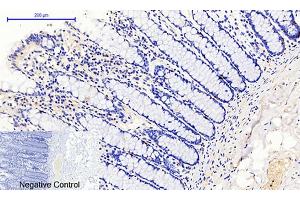 Immunohistochemical analysis of paraffin-embedded human colon tissue. (JAK1 抗体  (pTyr1022))