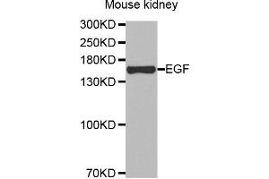 Western Blotting (WB) image for anti-Epidermal Growth Factor (EGF) antibody (ABIN3016522) (EGF 抗体)