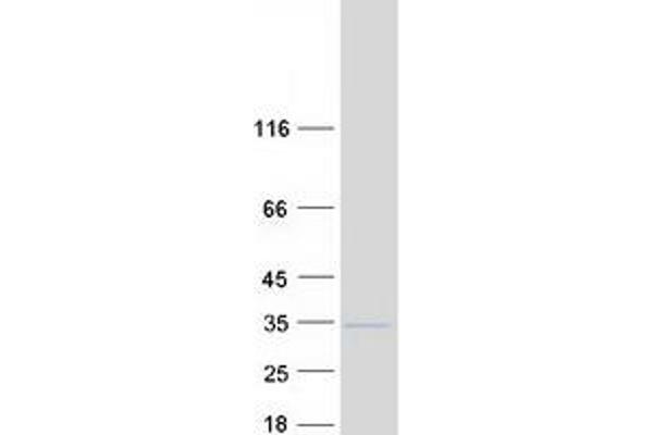 RPL7L1 Protein (Myc-DYKDDDDK Tag)