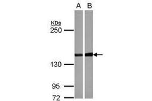 Image no. 2 for anti-Protein Phosphatase 2, Regulatory Subunit B'', alpha (PPP2R3A) (C-Term) antibody (ABIN1491841) (PPP2R3A 抗体  (C-Term))