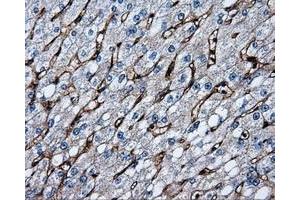 Immunohistochemical staining of paraffin-embedded liver tissue using anti-CD36mouse monoclonal antibody. (CD36 抗体)