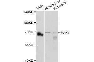 Western blot analysis of extracts of various cell lines, using PAK4 Antibody (ABIN5971470) at 1:3000 dilution. (PAK4 抗体)