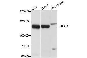 Western blot analysis of extracts of various cell lines, using XPO1 antibody (ABIN5970125) at 1/1000 dilution. (XPO1 抗体)