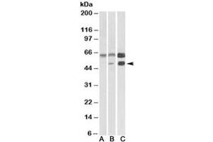 Western blot testing of human cerebellum [A], mouse brain [B], and rat brain [C] lysates with CAMK2A antibody at 0. (CAMK2A 抗体)