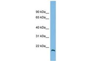 Image no. 1 for anti-Hemochromatosis Type 2 (Juvenile) (HFE2) (AA 35-84) antibody (ABIN6745034) (HFE2 抗体  (AA 35-84))