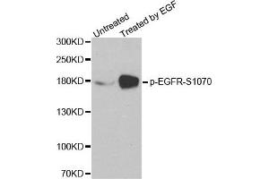 Western Blotting (WB) image for anti-Epidermal Growth Factor Receptor (EGFR) (pSer1070) antibody (ABIN1870119) (EGFR 抗体  (pSer1070))