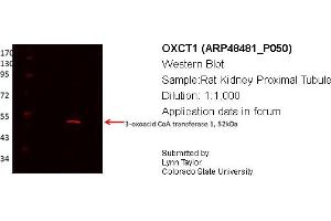 Western Blotting (WB) image for anti-3-Oxoacid CoA Transferase 1 (OXCT1) (Middle Region) antibody (ABIN311042) (OXCT1 抗体  (Middle Region))