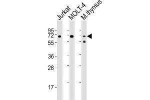 Lane 1: Jurkat Cell lysates, Lane 2: MOLT-4 Cell lysates, Lane 3: mouse thymus Cell lysates, probed with Zap70 (1484CT290. (ZAP70 抗体)