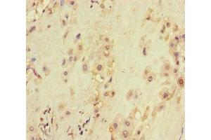 Immunohistochemistry of paraffin-embedded human placenta tissue using ABIN7175563 at dilution of 1:100 (VDAC2 抗体  (AA 2-36))