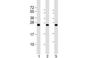 Western blot testing of human 1) A431, 2) HL-60 and 3) U2OS cell lysate with RAB5C antibody at 1:2000. (Rab5c 抗体)