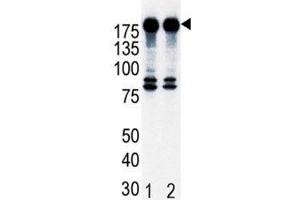 Western blot analysis of ErbB2 in T47D cell lysate, either noninduced (Lane 1) or induced with HRG (2). (ErbB2/Her2 抗体  (AA 21-52))