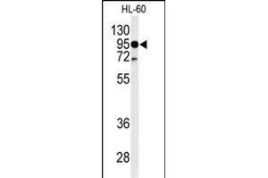 Western blot analysis of TLR4 Antibody (Center) (ABIN653638 and ABIN2842986) in HL-60 cell line lysates (35 μg/lane). (TLR4 抗体  (AA 669-698))