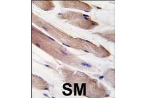 Formalin-fixed and paraffin-embedded human skeletal muscle tissue reacted with PIK3R1-p, which was peroxidase-conjugated to the secondary antibody, followed by DAB staining. (PIK3R1 抗体  (AA 558-587))