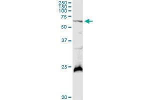 GALNT4 MaxPab rabbit polyclonal antibody. (GALNT4 抗体  (AA 1-578))