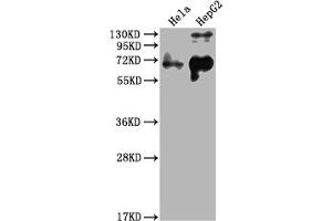 Western Blot Positive WB detected in: Hela whole cell lysate, HepG2 whole cell lysate All lanes: YAP1 antibody at 1:2000 Secondary Goat polyclonal to rabbit IgG at 1/50000 dilution Predicted band size: 55, 53, 49, 37, 49, 50, 51, 54 kDa Observed band size: 65 kDa (YAP1 抗体  (AA 155-504))