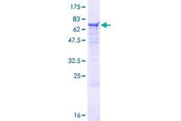 ZNF821 Protein (AA 1-370) (GST tag)