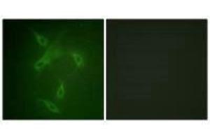 Immunofluorescence analysis of NIH/3T3 cells, using JAK2 (Ab-570) antibody. (JAK2 抗体  (Tyr570))