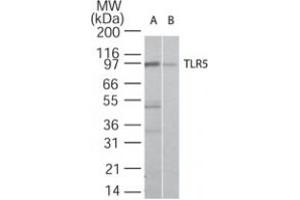 Image no. 1 for anti-Toll-Like Receptor 5 (TLR5) antibody (ABIN208236) (TLR5 抗体)