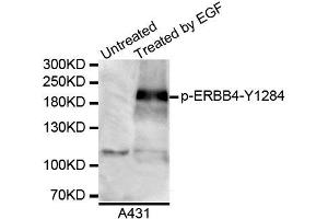 Western blot analysis of extracts of A431 cell line, using Phospho-ERBB4-Y1284 antibody. (ERBB4 抗体  (pTyr1284))