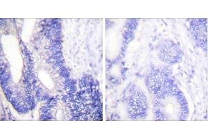 Peptide - +Immunohistochemical analysis of paraffin-embedded human colon carcinoma tissue using Claudin 3 antibody. (Claudin 3 抗体)