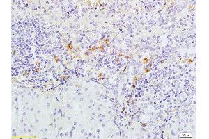 Immunohistochemistry (Paraffin-embedded Sections) (IHC (p)) image for anti-Caspase 3 (CASP3) (AA 60-100) antibody (ABIN724625)