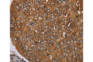 Immunohistochemistry (IHC) image for anti-Pim-3 Oncogene (PIM3) antibody (ABIN2434924) (PIM3 抗体)