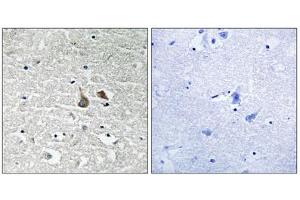 Immunohistochemistry analysis of paraffin-embedded human brain tissue using IRAK1 (Phospho-Ser376) antibody. (IRAK1 抗体  (pSer376))