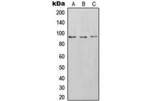 Western blot analysis of CD54 expression in Saos2 (A), HT1080 (B), Raji (C) whole cell lysates. (ICAM1 抗体  (C-Term))
