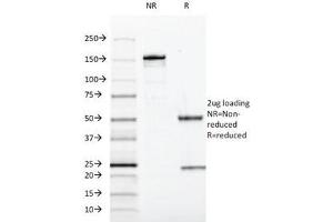 SDS-PAGE (SDS) image for anti-SRY (Sex Determining Region Y)-Box 10 (SOX10) (AA 115-269) antibody (ABIN5646947)