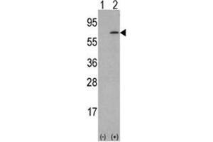Western blot analysis of M-CSF (arrow) using rabbit polyclonal M-CSF Antibody (Center) . (M-CSF/CSF1 抗体  (Middle Region))