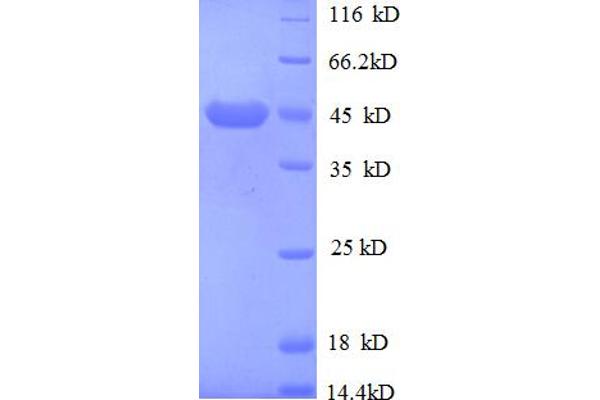 M6PR Protein (AA 2328-2491, partial) (GST tag)