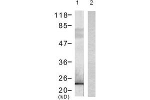 Western blot analysis of extract from 293 cells transfected with (lane 1) or without (lane 2) DYKDDDDK-tagged Bad using DYKDDDDK-Tag monoclonal Antibody (E1T508). (DYKDDDDK Tag 抗体)