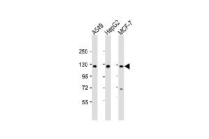 Western Blot at 1:2000 dilution Lane 1: A549 whole cell lysate Lane 2: HepG2 whole cell lysate Lane 3: MCF-7 whole cell lysate Lysates/proteins at 20 ug per lane. (Klotho beta 抗体  (AA 1-29))