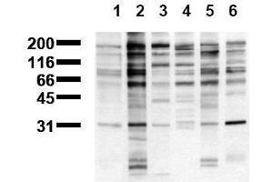 Western Blotting (WB) image for anti-Phosphotyrosine (phosphorylated) antibody (ABIN126874) (Phosphotyrosine 抗体  (phosphorylated))