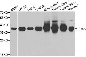 Western blot analysis of extracts of various cell lines, using PDXK antibody (ABIN5974032) at 1/1000 dilution. (PDXK 抗体)