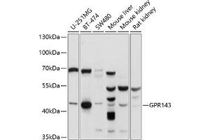 Western blot analysis of extracts of various cell lines, using GPR143 antibody (ABIN6131675, ABIN6141346, ABIN6141347 and ABIN6214863) at 1:1000 dilution. (GPR143 抗体  (AA 314-404))