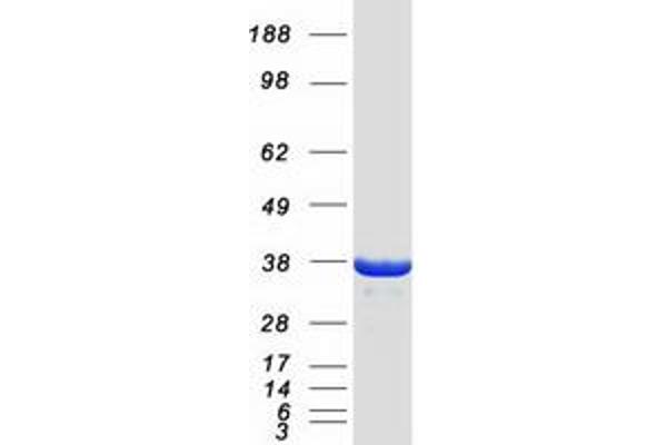 IFI35 Protein (Myc-DYKDDDDK Tag)