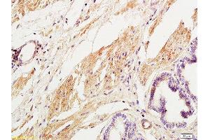 Immunohistochemistry (Paraffin-embedded Sections) (IHC (p)) image for anti-Collagen, Type III (COL3) (AA 1301-1400) antibody (ABIN669981)