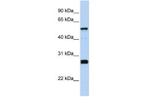 Western Blotting (WB) image for anti-Family with Sequence Similarity 83, Member F (FAM83F) antibody (ABIN2459545) (FAM83F 抗体)