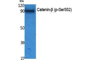 Western Blotting (WB) image for anti-Catenin, beta (CATNB) (pSer552) antibody (ABIN3173575) (beta Catenin 抗体  (pSer552))