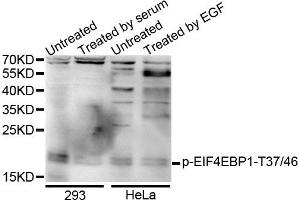 Western blot analysis of extracts of various cells, using Phospho-EIF4EBP1-T37/46 antibody. (eIF4EBP1 抗体  (pThr36))