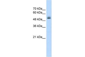 Western Blotting (WB) image for anti-Pre-mRNA Processing Factor 19 (PRPF19) antibody (ABIN2462670) (PRP19 抗体)