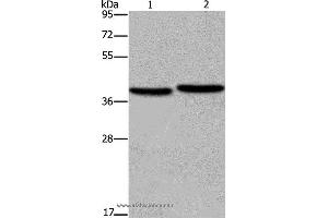 Western blot analysis of MCF-7 and NIH/3T3 cell, using FHL1 Polyclonal Antibody at dilution of 1:400 (FHL1 抗体)