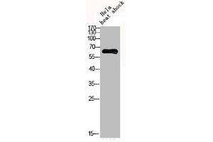 Western Blot analysis of HELA cells using Phospho-AMPKα1 (S496) Polyclonal Antibody (PRKAA1 抗体  (pSer469))