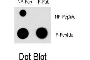 Image no. 1 for anti-Myocyte Enhancer Factor 2C (MEF2C) (pSer396) antibody (ABIN5552137) (MEF2C 抗体  (pSer396))