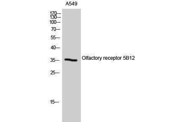 OR5B12 抗体  (Internal Region)