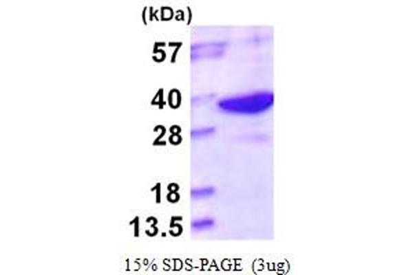 LHPP Protein (AA 1-270) (His tag)